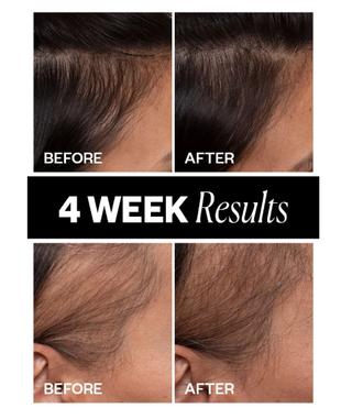 IGK Sponsored Hair Density Scalp Treatment
