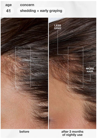 FutureIQ Biomimetic Hair Longevity Serum-