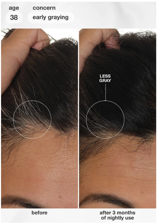 FutureIQ Biomimetic Hair Longevity Serum-